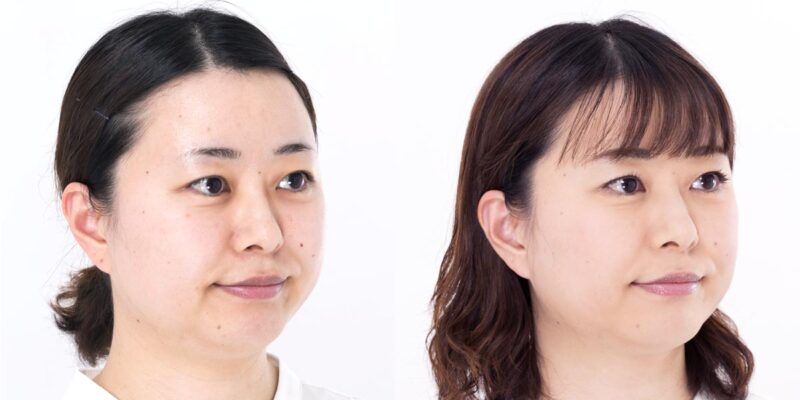 モデルビフォーアフター